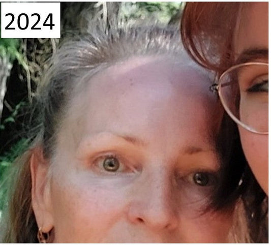 How I Got My Hair to Regrow